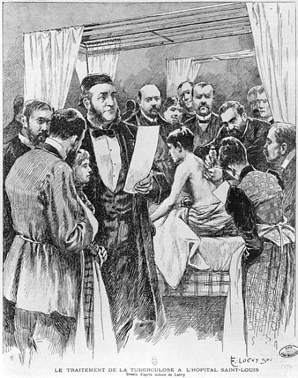The treatment of tuberculosis at St. Louis hospital, Paris à Edward Loevy