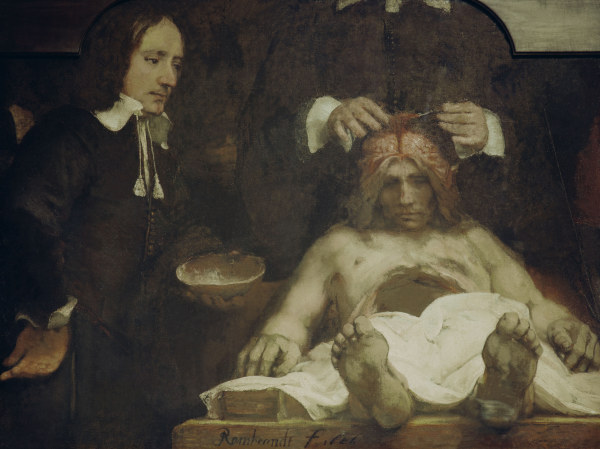 Rembrandt, Anatomie des Dr.J.Deijman à Rembrandt Harmenszoon van Rijn